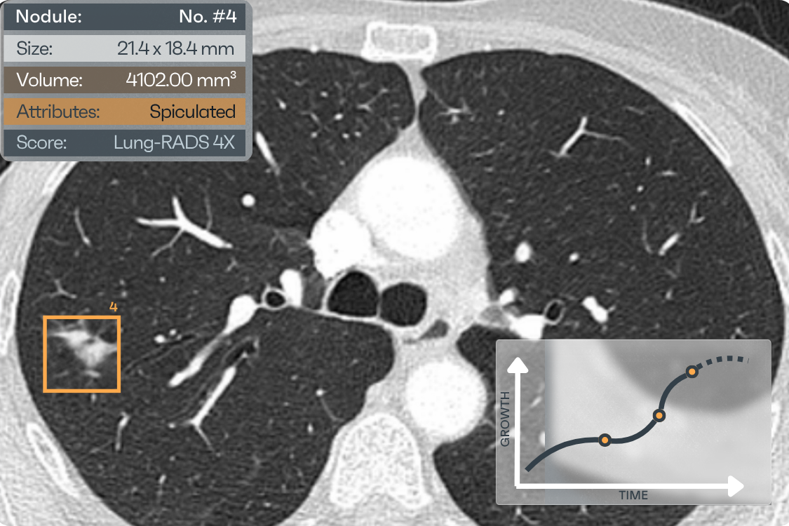 AI detection placeholder