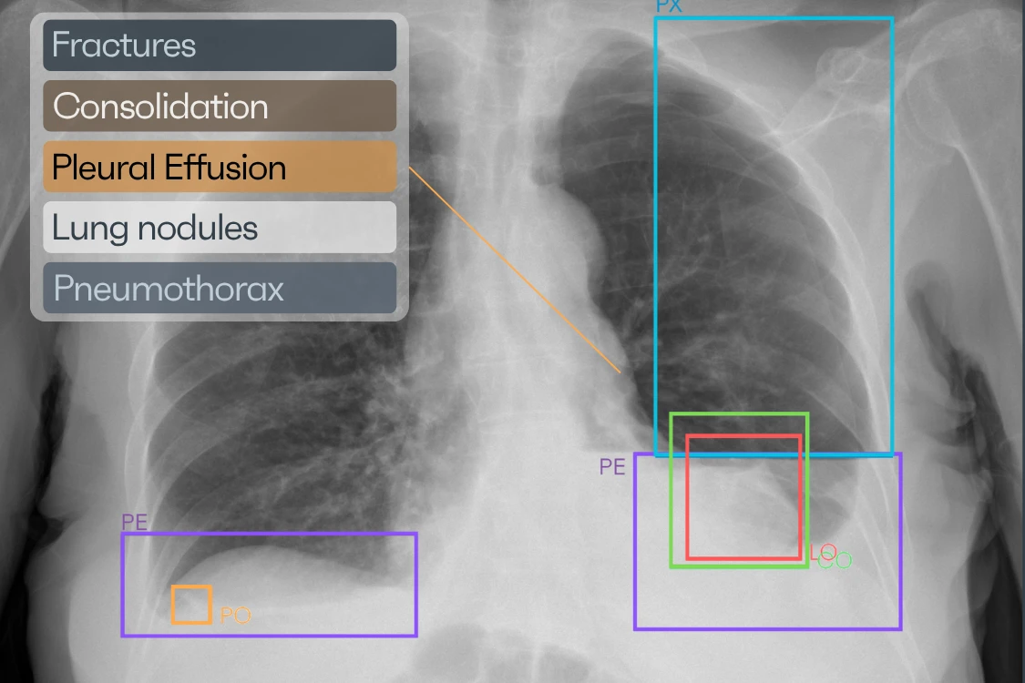 AI detection X-ray placeholder