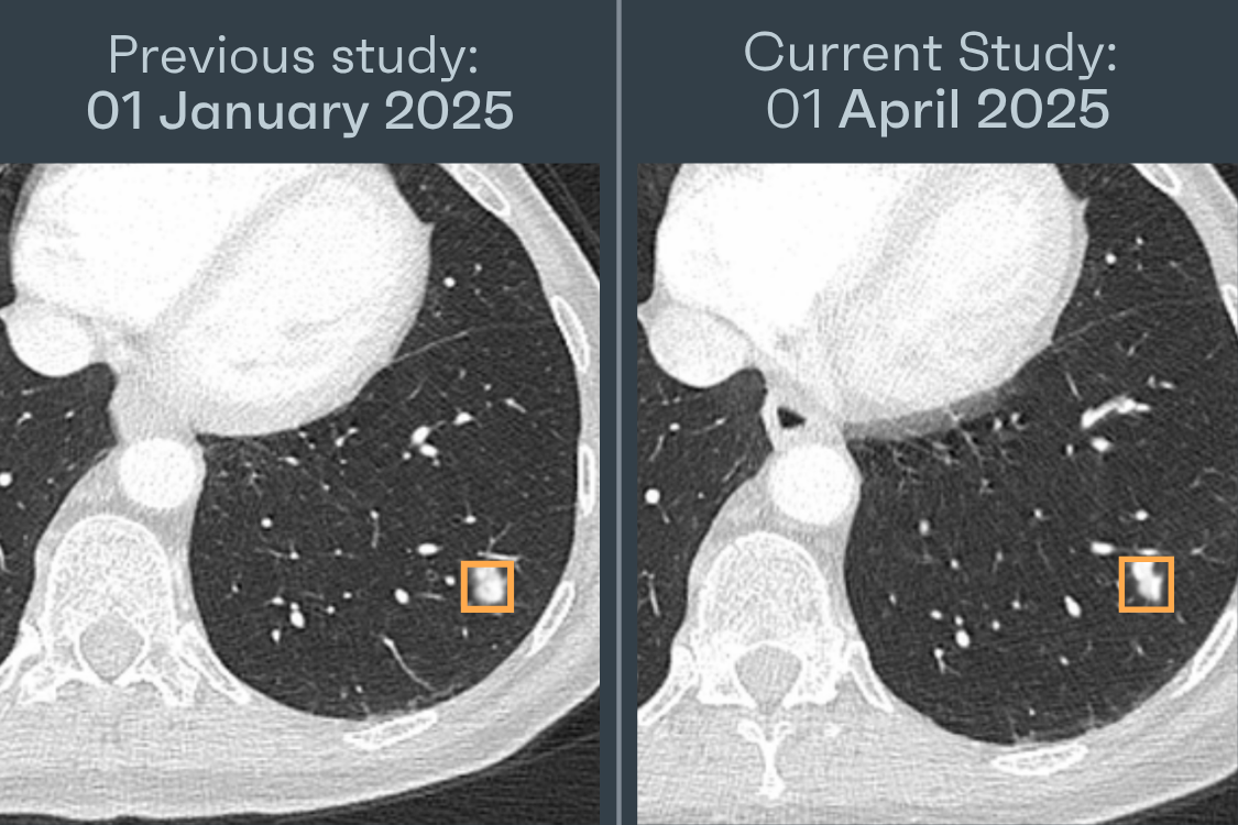 Comparative analysis placeholder