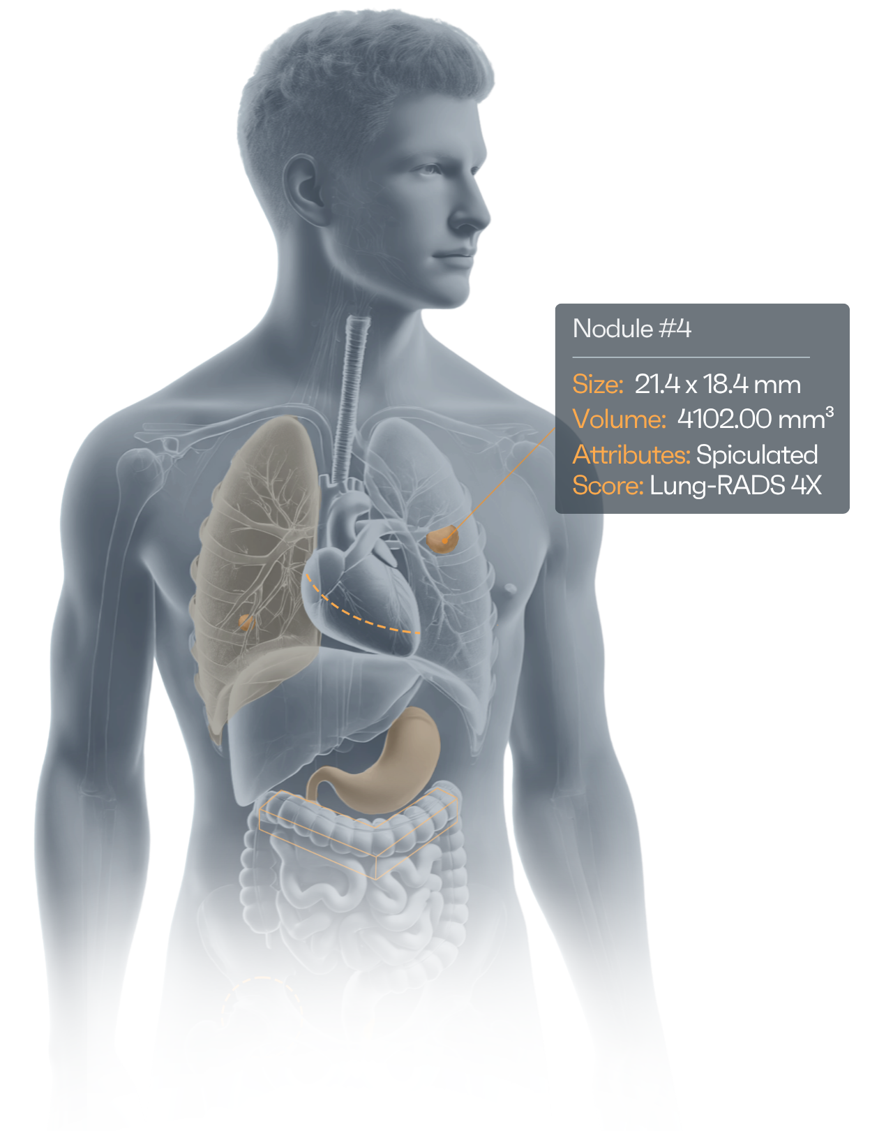 Human CT illustration
