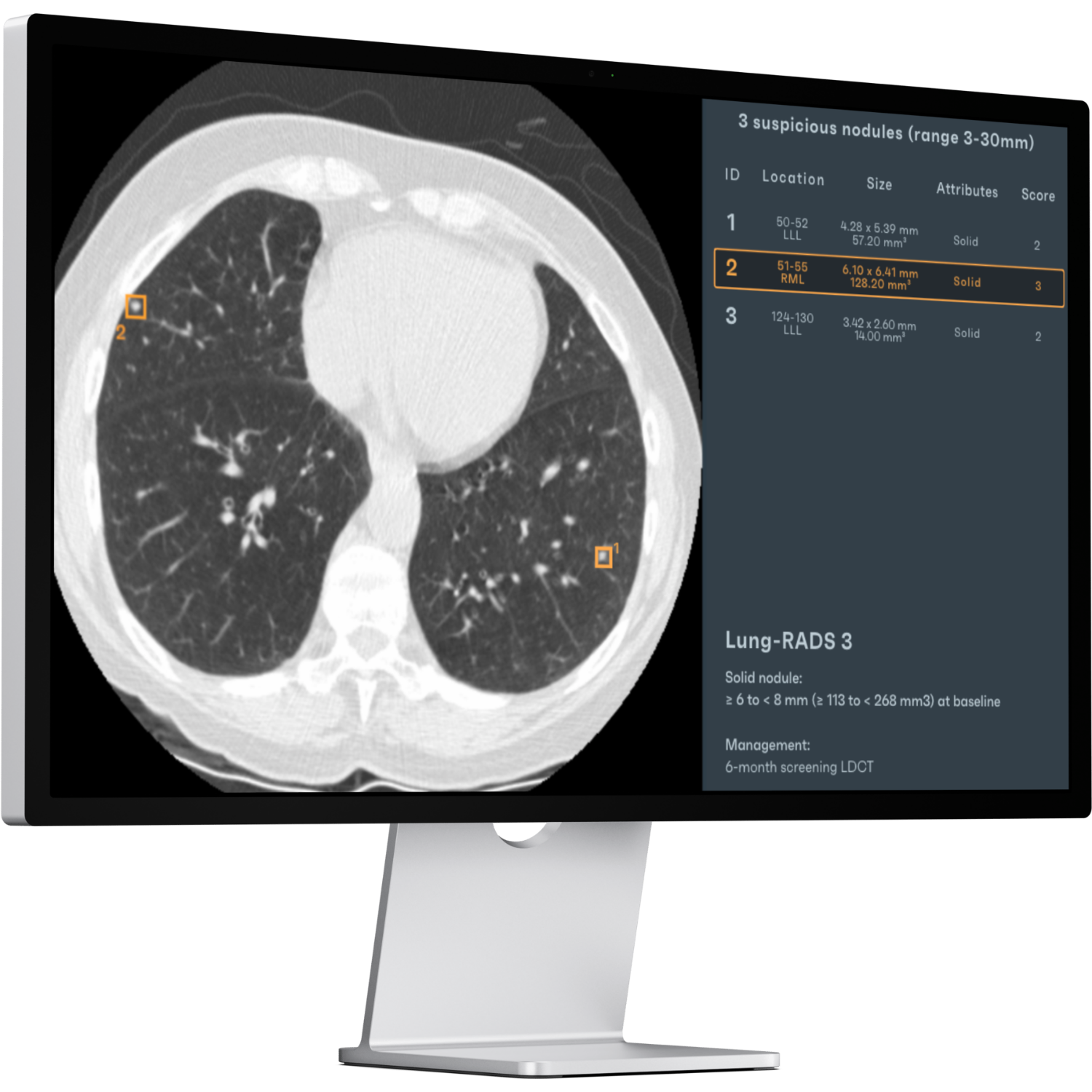 Lung CT clinical evidence preview