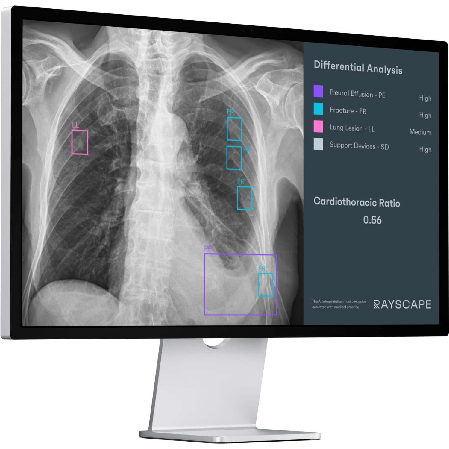 Chest X-ray clinical evidence preview